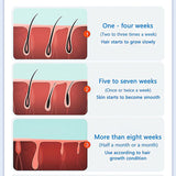 IPL Laser Epilator Permanent Hair Remover Device Home Use Face Body Bikini Hair Removal