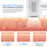 IPL Laser Hair Removal Ice Epilator Bikini Whole body Sapphire Depilator Upgraded Model laser hair