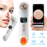 New Visible Wifi Heating Blackhead Remover Pore Vacuum Cleaner For Nose Face Skin Acne LCD Display