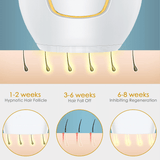 Hair Removal IPL Epilator