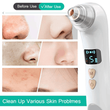 Visible Wifi Heating Blackhead Remover Pore Vacuum Cleaner