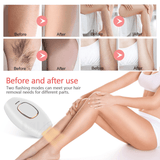 Hair Removal IPL Epilator