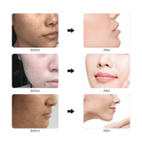 Diamond Microdermabrasion Machine Skin Peeling Anti Aging Exfoliator