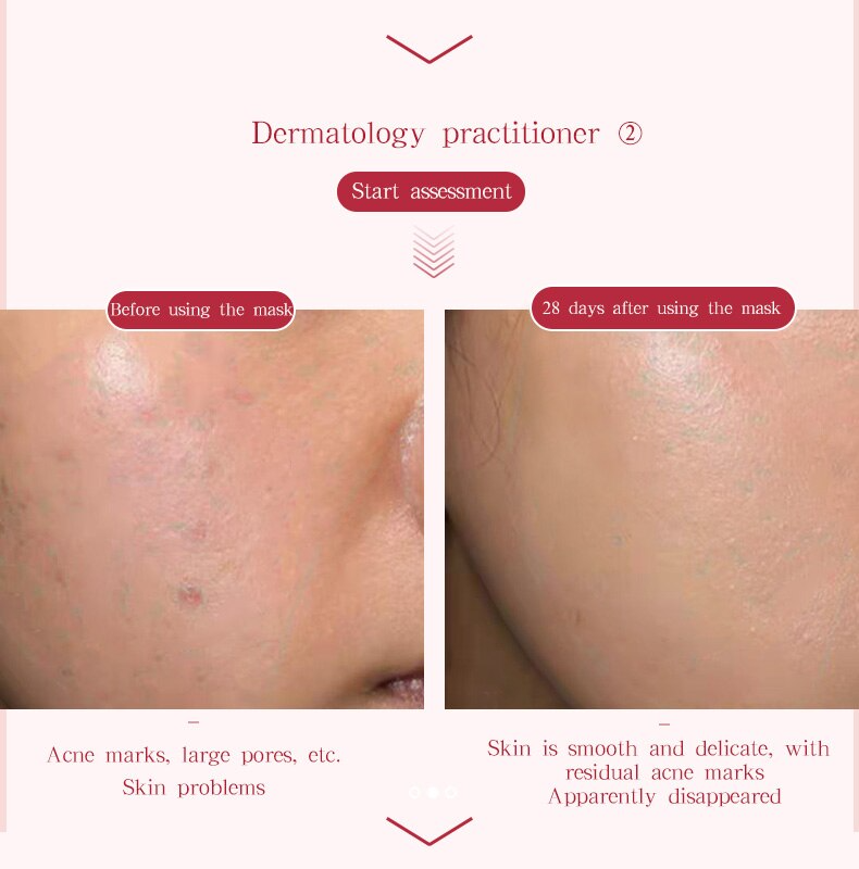 Led Beauty Mask SPA Light Therapy Mask Face Lift Facial Skin Rejuvenation Care Tool