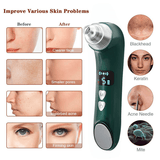 Visible Wifi Heating Blackhead Remover Pore Vacuum Cleaner