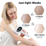 Painless hair removal laser epilator whole body photorejuvenation epilator