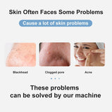 Ultrasonic Skin Deep Cleaner Peeling Shovel Facial Pore Cleaner Skin Care