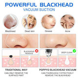 Electric Blackhead Remover Vacuum Suction Facial Pore Cleaner Exfoliating Beauty Tools