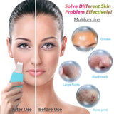 Facial exfoliating pore cleaning tool facial care skin scrubber skin beauty instrument